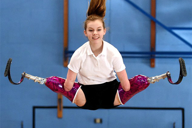 身残志坚！英12岁残疾少女获蹦床比赛冠军（组图）